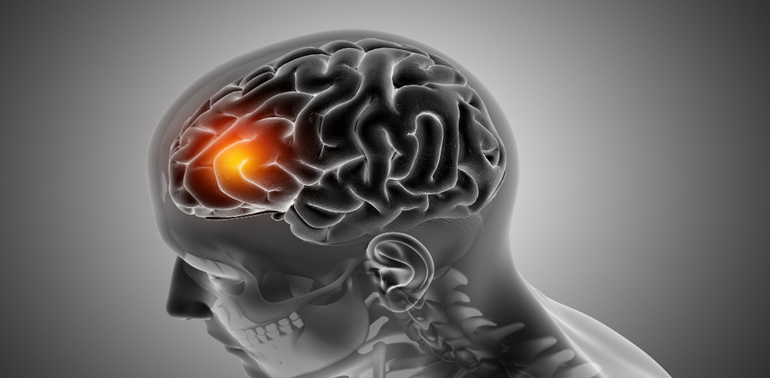 Acupunctur therapy